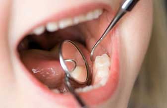 Dentista Adulto E Crianças - Foto 1