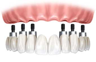 Cirurgião Dentista Ortodontia - Foto 1